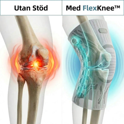 FlexKnee | Återfå styrkan i ditt knä.